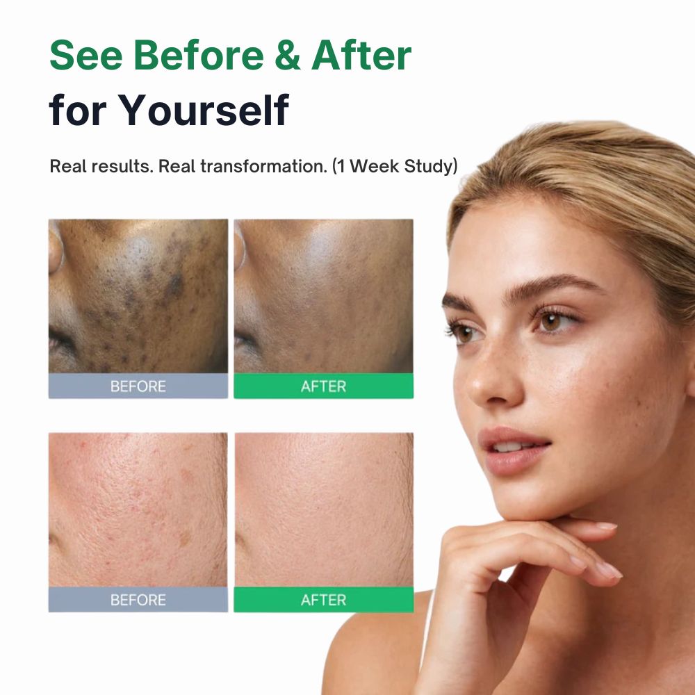 Melatoning Oneday Ampoule Serum (EGF 5x)