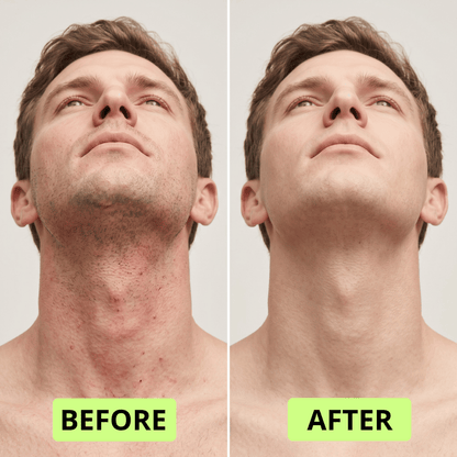 Needo 2-in-1 Shave & Cleanse Stick