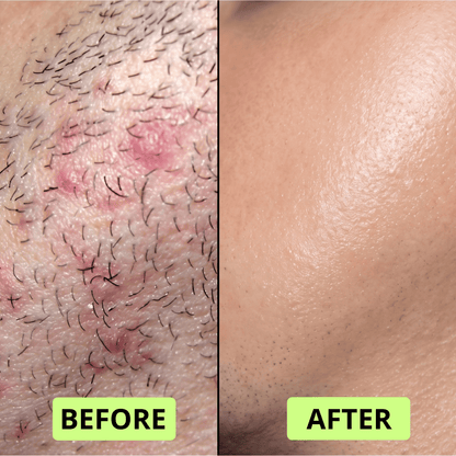 Needo 2-in-1 Shave & Cleanse Stick
